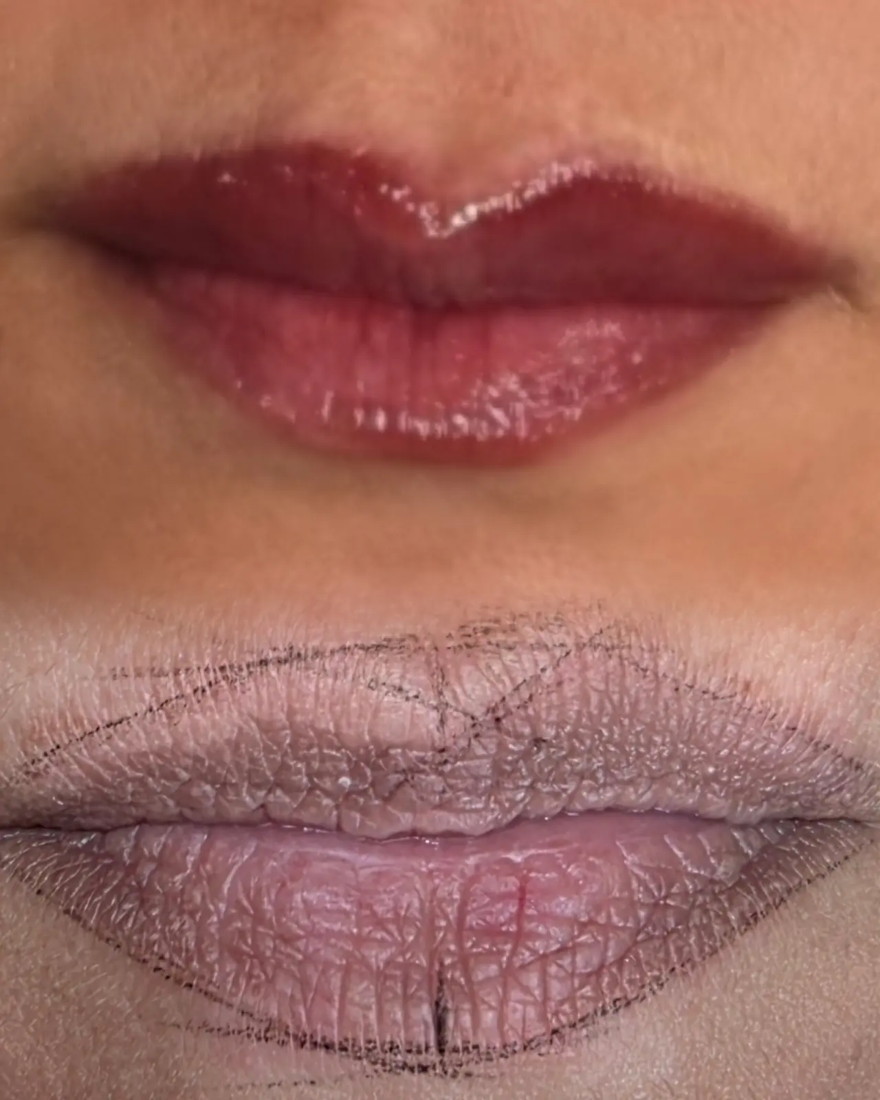 Dark Lips — avant / après — résultat réalisé au studio Dermagrafia