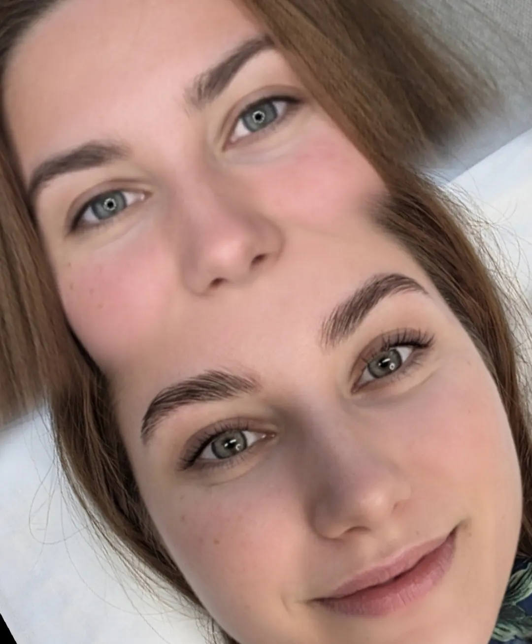 Lash Filler — avant / après — résultat réalisé au studio Dermagrafia